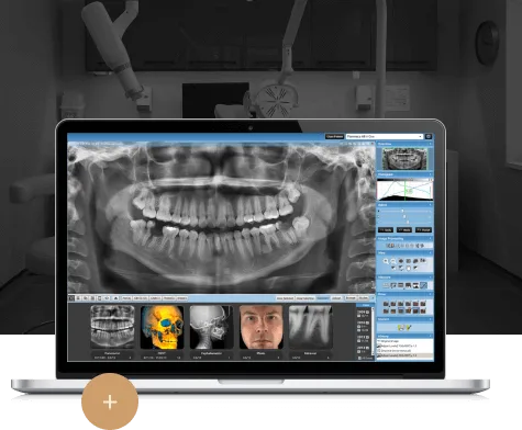 Одномоментная имплантация зуба