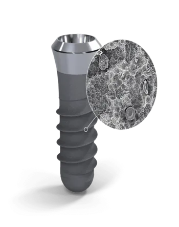 Импланты Straumann