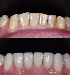 Результаты лечения