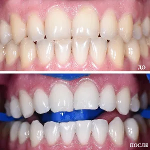 Результаты лечения