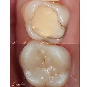 Результаты лечения