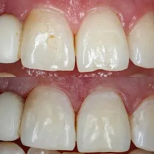 Результаты лечения