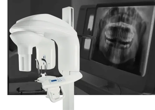 Трейнеры и пластинки для зубов