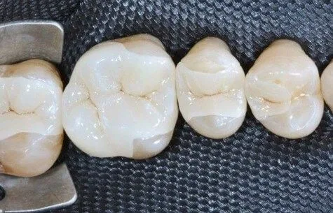 Диоксид циркония