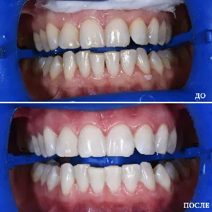 Результаты лечения