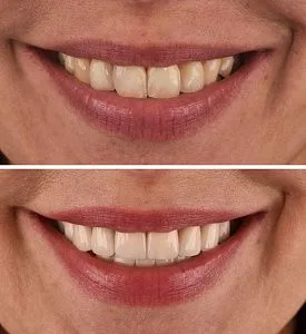 Результаты лечения