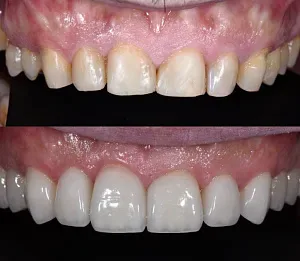 Результаты лечения