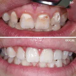 Результаты лечения