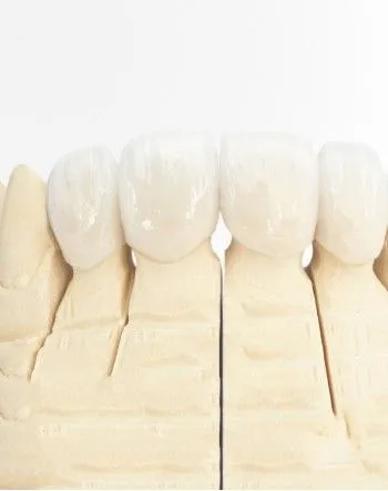 Цельнокерамические реставрации