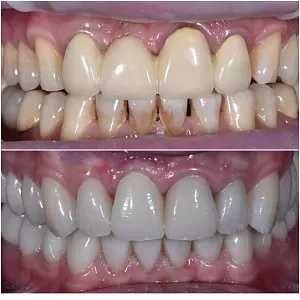 Результаты лечения