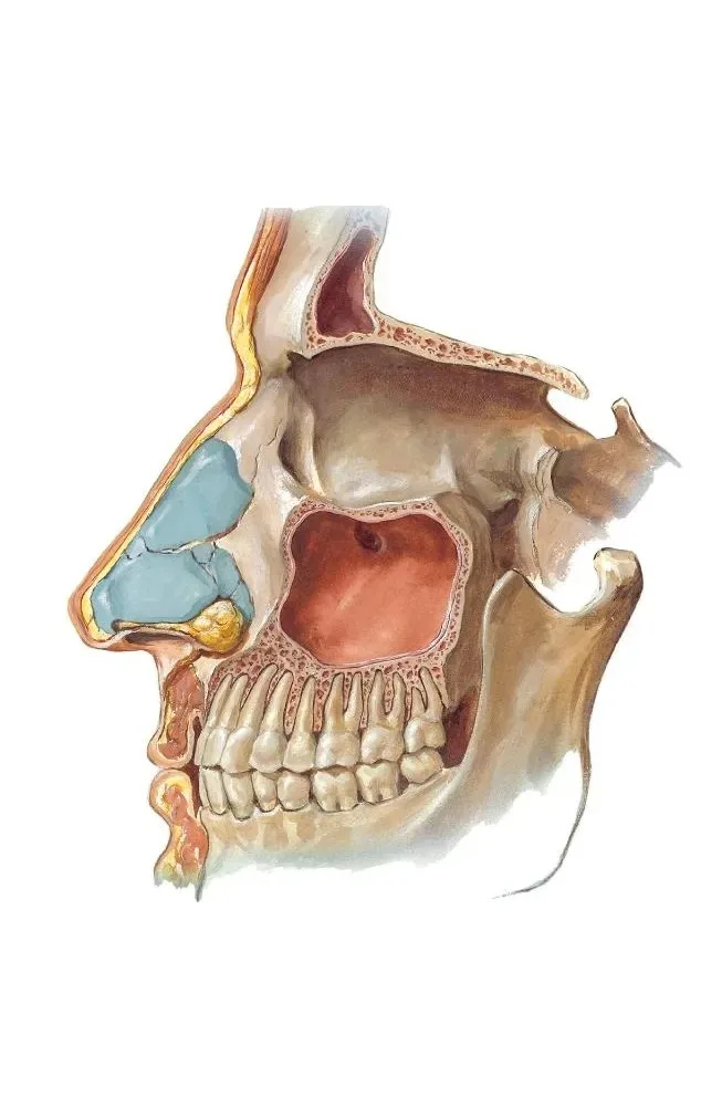 Имплантация верхней челюсти специфика