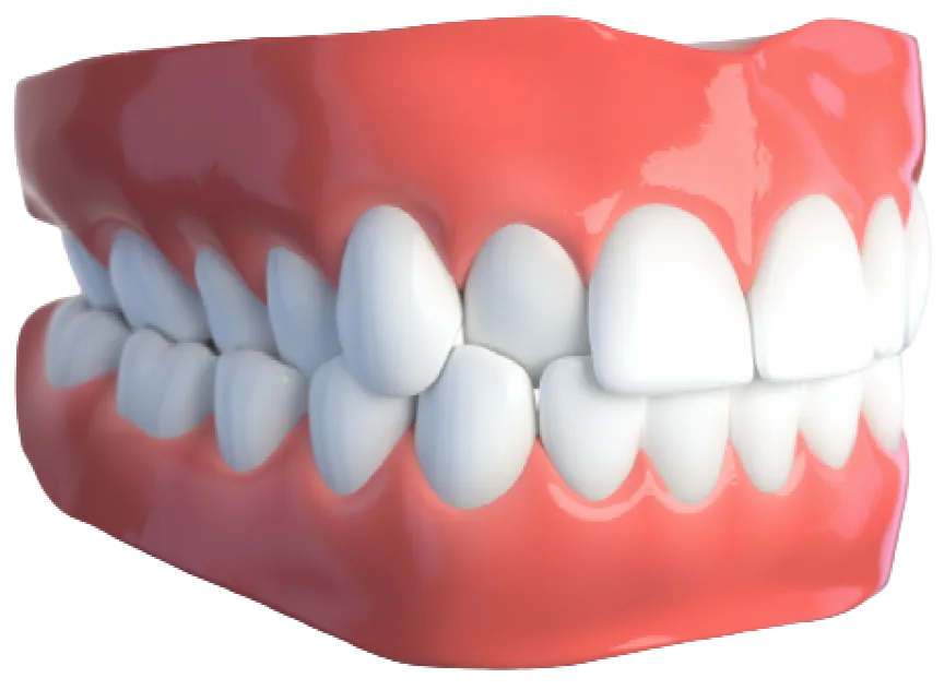 Перекрестный прикус