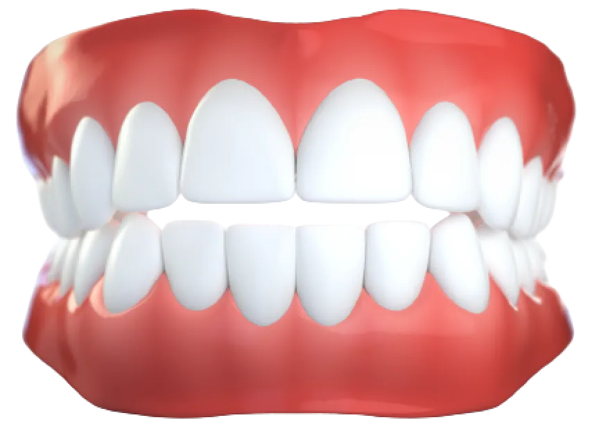 Открытый прикус