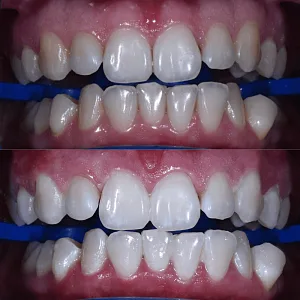 Эстетическая стоматология