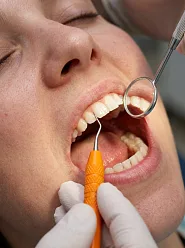 Лечение десен, пародонтита