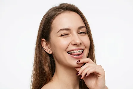 Металлические брекеты