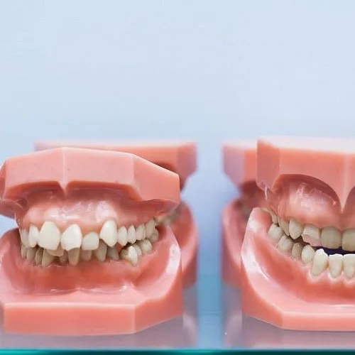 Прикус зубов правильный и неправильный: как определить?