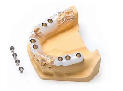 Навигационная 3D-имплантация зубов