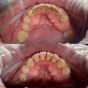 Результаты лечения