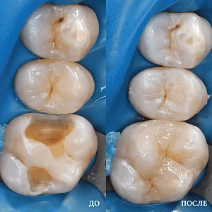 Результаты лечения