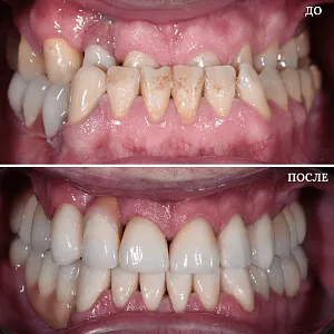 Результаты лечения