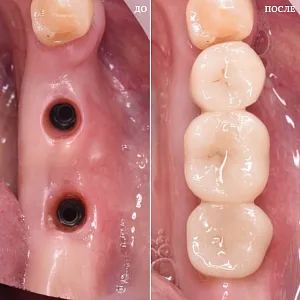 Результаты лечения