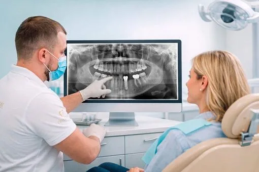 Имплантация зубов: как пациент проходит путь от КТ до постоянной коронки