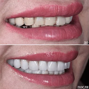 Результаты лечения