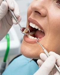 Лечение зубов
