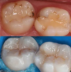 Результаты лечения