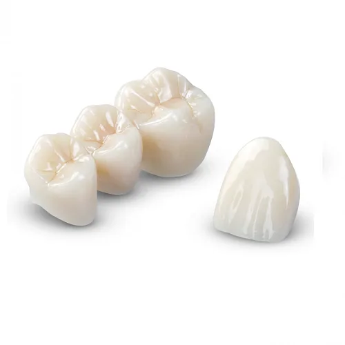 Почему коронки из диоксида циркония стоят дороже?