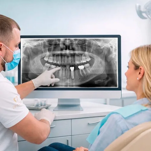 Имплантация зубов: как пациент проходит путь от КТ до постоянной коронки