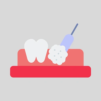 Аутокостная пластика – современная методика восстановления кости