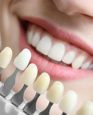 Рекомендации после отбеливания зубов